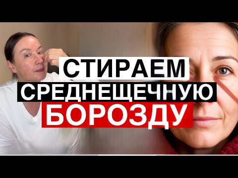 Стираем СРЕДНЕ ЩЕЧНУЮ БОРОЗДУ 