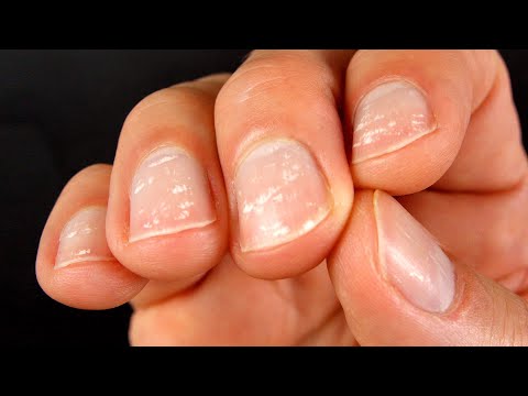 What's wrong with my nails?
