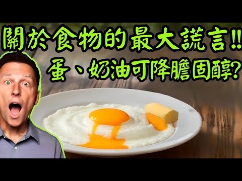 吃蛋和奶油,可降膽固醇？自然療法,柏格醫生 Dr Berg