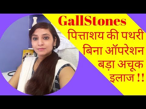 Gallstones symptoms & homeopathic treatment | gallbladder stones symptoms & homeopathic medicine
