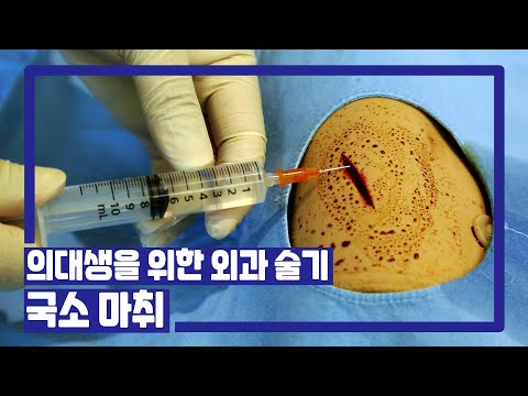 [서울성모병원] 외과 술기 5. 국소 마취