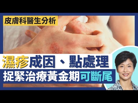 濕疹成因唔只遺傳因素、壓力大 捉緊治療黃金期可斷尾!急性濕疹同慢性濕疹症狀大不同!天氣乾燥痕癢出疹唔一定係濕疹唔好亂搽藥膏!|王建芳醫生 皮膚科醫生林嘉雯醫生|人類健康研究所