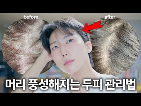After losing 10 million won to hair loss, I discovered this scalp care routine that gives me thic...
