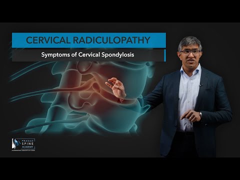 What is Cervical Radiculopathy?