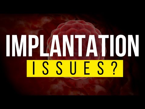 How to know if I have implantation issues - Watch this