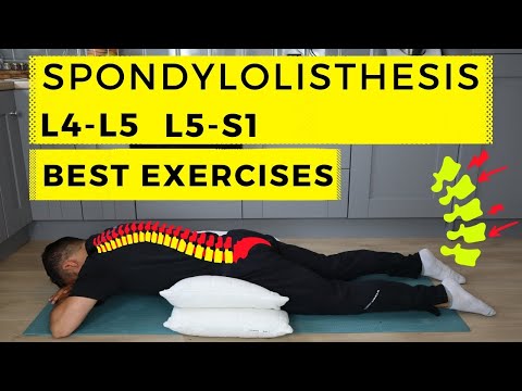 Spondylolisthesis treatment