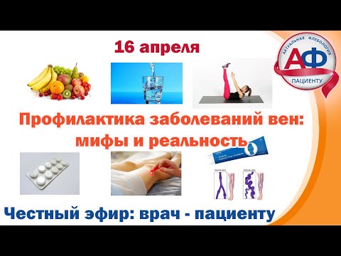 Prevention of vein diseases: myths and reality