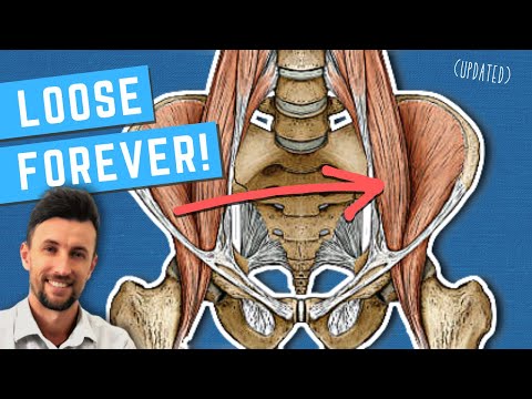 How to Permanently Loosen a Tight Psoas (Updated)