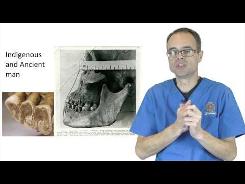 The Cause And Cure Of Bruxism And Clenching By Dr Mike Mew