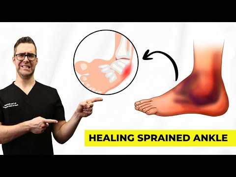 How Heal a Sprained Ankle FAST [Top 10 Cures]