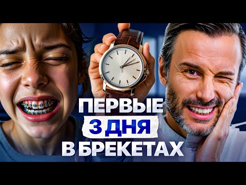Первые 72 часа после установки брекетов. Что вас ждет?