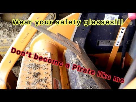 The story of How I DESTROYED my eye! Blind in one eye and the bizarre way it happened.