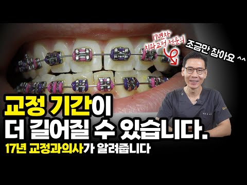 치아 교정 기간 단축하는 7가지 방법 총정리! 병원 너무 자주가지 마세요