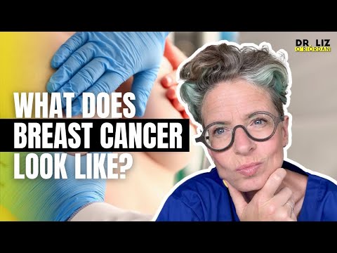 Do NOT Ignore These 11 Breast Changes | Not Just Lumps!