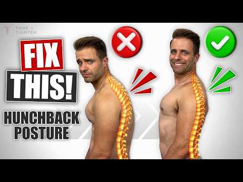 The Real Fix for Hunchback Posture [Do THIS Daily!]