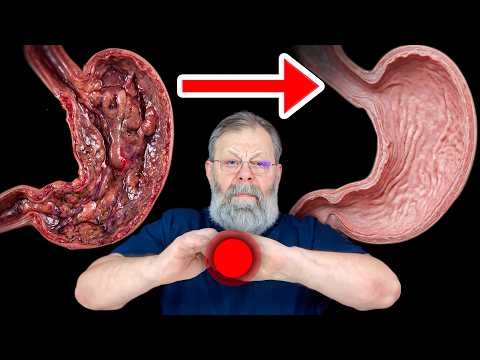 ➡️Stomach hurts — I’ll show you a stomach‑relief move