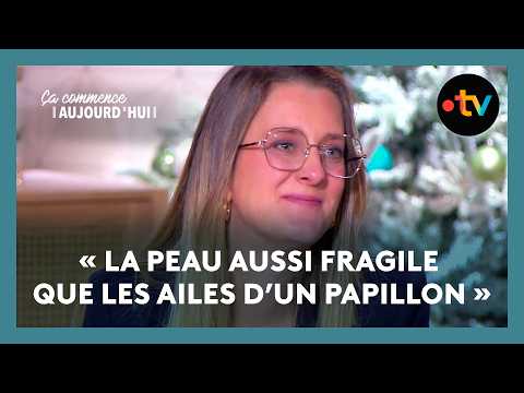 Le fils de Marie, Paul, vit avec une épidermolyse bulleuse dystropique