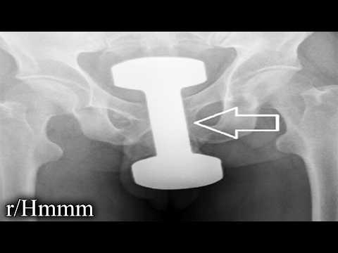 35 minutes of extremely odd reddit pics