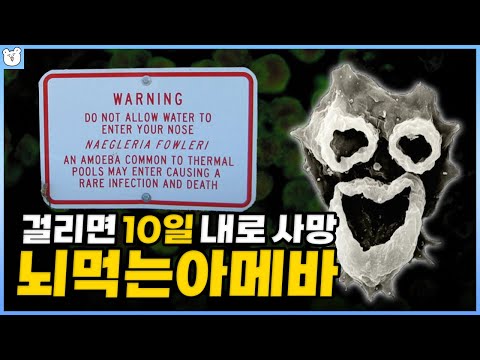 치사율 95%의 뇌 먹는 아메바 ㅇㅇㅇ만 있으면 피할 수 있다고?｜파울러 자유 아메바 증상, 감염경로, 예방법