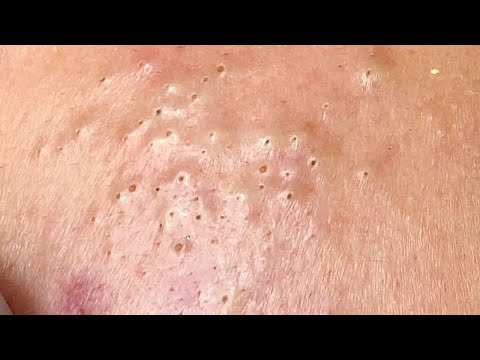 Relax Every Day With Sac Dep Spa #0055 ( Part 2 of #0050 )