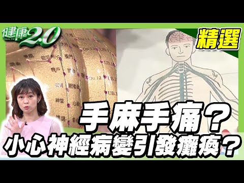 手麻手痛？小心神經病變引發癱瘓？【健康2.0精選】