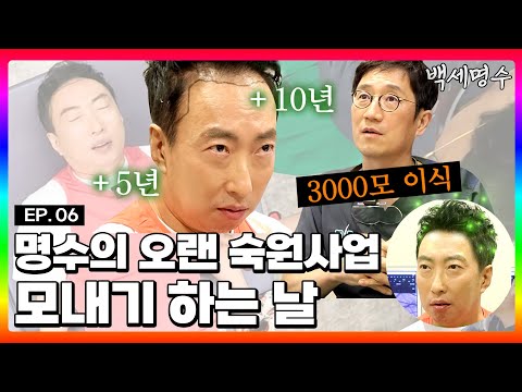 드디어 모발이식 받으러 온 탈모인 박명수 | [백세명수] EP.06