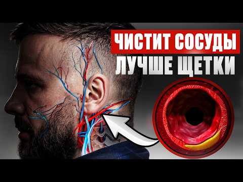 How to clear blood vessels of plaque and blood clots in 5 simple steps