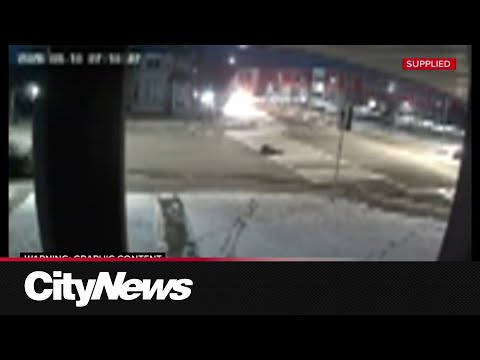 12-year-old Calgary boy recovering after hit-and-run