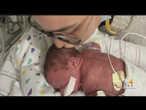 Baby born at 22 weeks leaving Boston hospital after more than 200 days in NICU