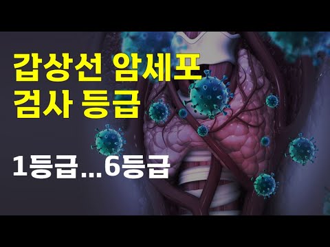 갑상선 암세포 검사 등급 이해하기 _ 베데스다 등급