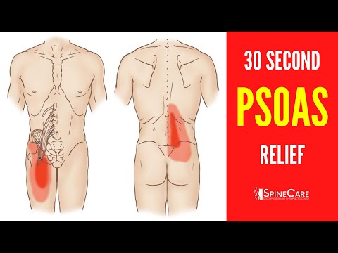 How to Fix a Tight Psoas Muscle in 30 SECONDS