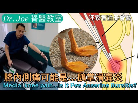 膝內側痛可能是…鵝掌滑囊炎 ［Eng Subtitles] Medial knee pain…is it Pes Anserine Bursitis?