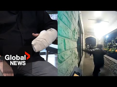 Couple speaks out after husband injured in violent Toronto home invasion