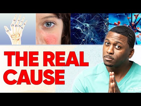 The Truth About Lupus, MS, RA & Autoimmune Disorders