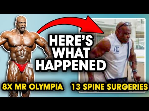 Ronnie Coleman: Mr. 8x Olympia to 13 Spine Sugeries. Here's what happened...