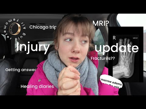 Recovery isn't going as planned...A Week in My Life as a Ballerina | WIEIAD & Femometer Review
