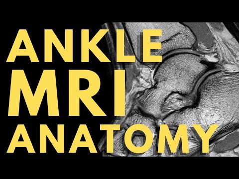 Ankle MRI Anatomy | Radiology anatomy part 1 prep | How to interpret an ankle MRI