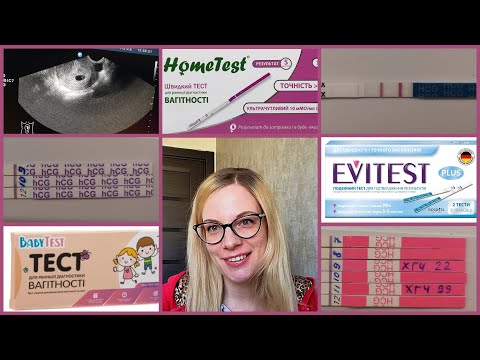 Беременность в 38 лет// Как узнала// ТЕСТЫ// Признаки// УЗИ//