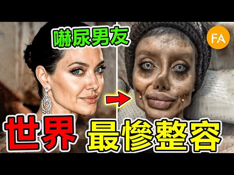 世界最慘的十個整容悲劇，邁克爾傑克遜竟然上榜，第一名堪稱人形怪物，男友差點被嚇死！- 旅行紀錄片