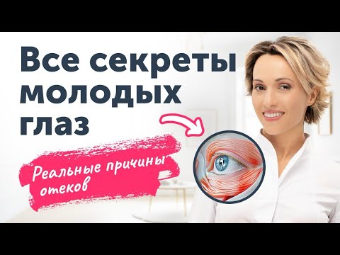 Все секреты молодых глаз + полезные упражнения. Где кроются реальные причины отёков?