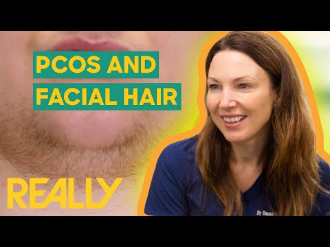Dr. Emma Helps Patient With PCOS and Facial Hair | The Bad Skin Clinic