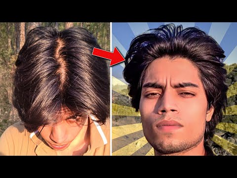 Everything I did to Save My Hair