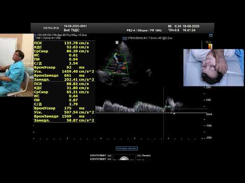 Стандартизованное транскраниальное дуплексное сканирование (ТКДС) (профессор Куликов В.П.)