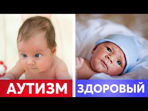 Ранние признаки АУТИЗМА! Должен знать КАЖДЫЙ РОДИТЕЛЬ!