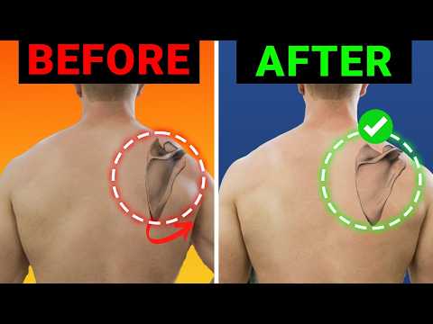 The Ultimate Scapular Winging Fix (do this every day)