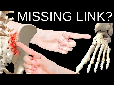 Chronic SI Joint Pain? Your Feet May Be The Problem.