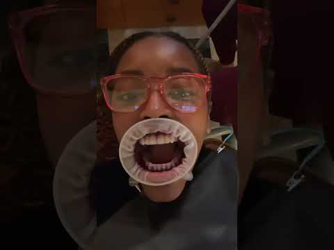 5 star dental service with spa like treatment🤩 #dentist #toronto #luxury #pastedental