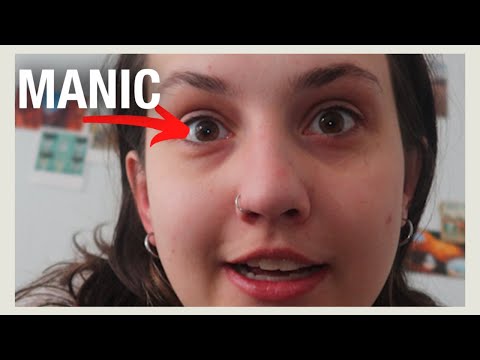 7 days of hypomania documented