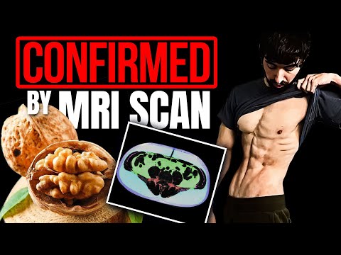 Specific Foods to Burn Visceral Fat: Randomized Controlled Trial