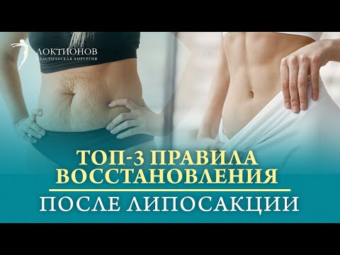 Реабилитация после операции липосакция | Как быстро восстановиться и прийти в форму